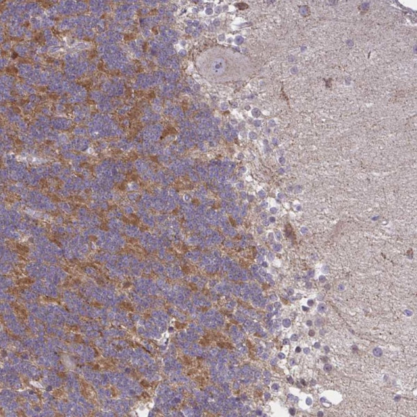 Anti-GPRIN3