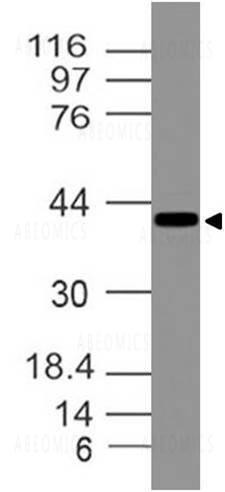 Anti-Ataxin-3 (Clone: ABM30C2)