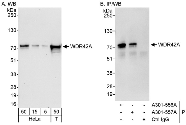 Anti-WDR42A