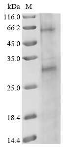 NADH dehydrogenase subunit 2 (nad2), Psoroptes ovis, recombinant