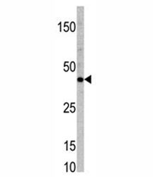 Anti-TCF7