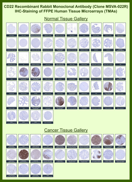 Anti-CD22 / BL-CAM (B-Cell Marker), recombinant antibody, clone MSVA-022R