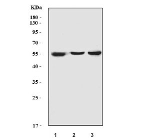 Anti-CYP2E1 / Cytochrome P450 2E1, clone 2C7G1