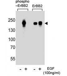 Anti-HER2 (ERBB2) (phospho-Y1112)