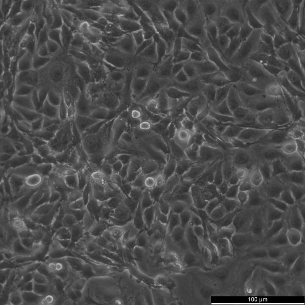 J82 Cells