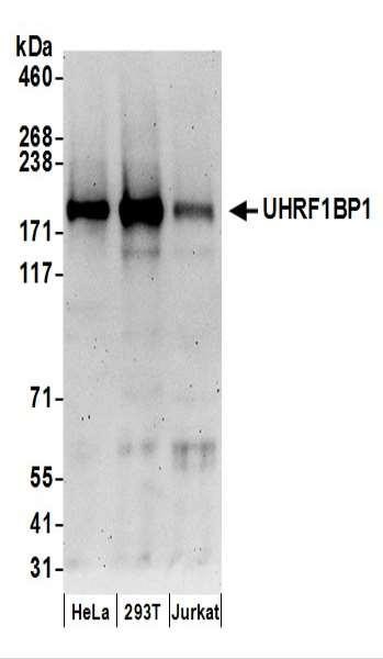 Anti-UHRF1BP1
