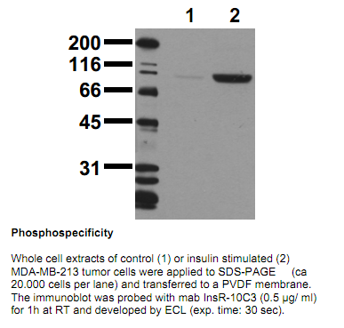 Anti-phospho-Insulin Receptor (Tyr1150/1151), clone 10C3