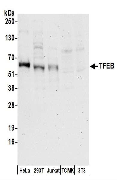 Anti-TFEB