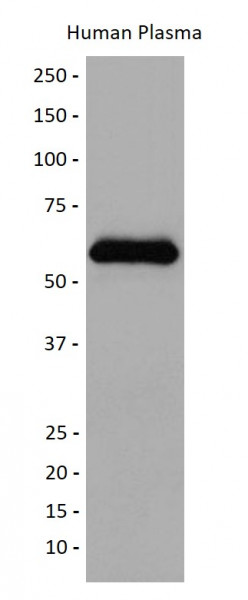 Anti-alpha 1 Antichymotrypsin