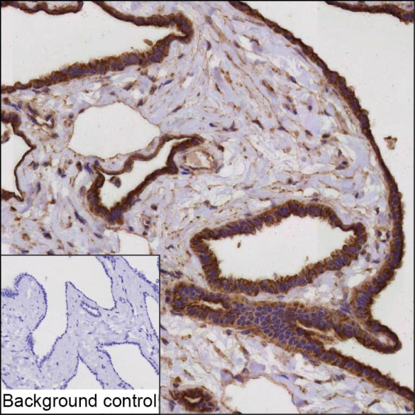 Anti-NF2
