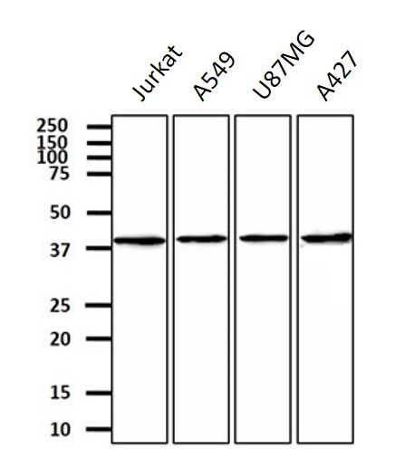 Anti-CTGF, clone 18E7