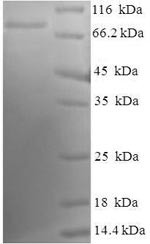 Tyrosine-protein kinase Lck (LCK), human, recombinant