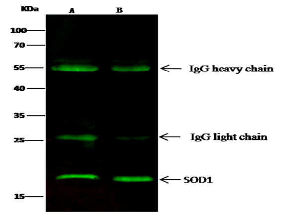 Anti-SOD1/Superoxide Dismutase Monoclonal Antibody