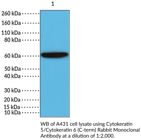 Anti-Cytokeratin 5/Cytokeratin 6 (C-Term) Rabbit Monoclonal Antibody (Clone RM341)
