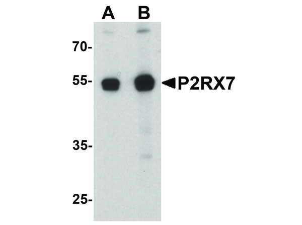 Anti-P2RX7