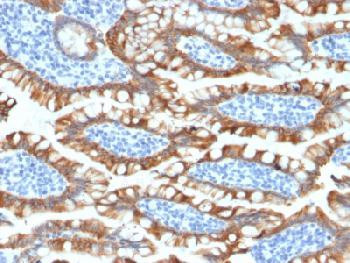 Anti-Cytokeratin 8 (KRT8) Recombinant Rabbit Monoclonal Antibody (clone:KRT8/2174R)