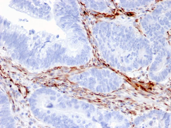 Anti-Nestin (Cancer Stem Cell Marker)(NES/2911), CF405S conjugate, 0.1mg/mL