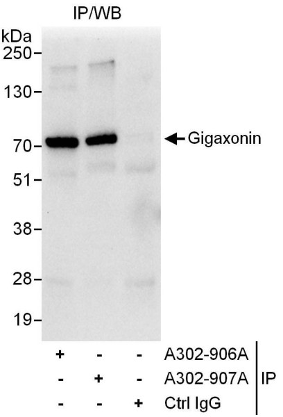 Anti-Gigaxonin