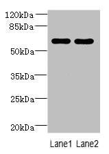 Anti-ZNF215