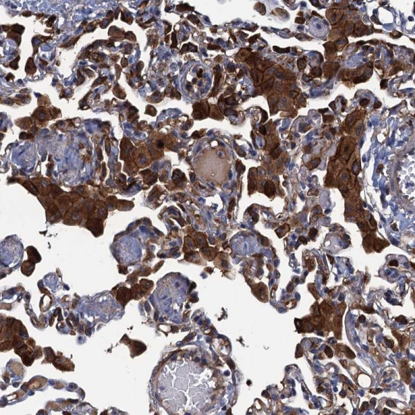 Anti-DNHD1