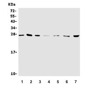 Anti-Neurotrophin 4 / NTF4