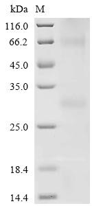 Melanocortin receptor 5 (MC5R), recombinant human