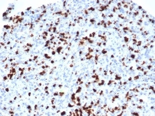 Anti-TIA-1 / T-Cell Intracellular Antigen-1, clone TIA1/1352R
