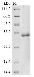 Protein mono-ADP-ribosyltransferase PARP9 (PARP9), partial, human, recombinant