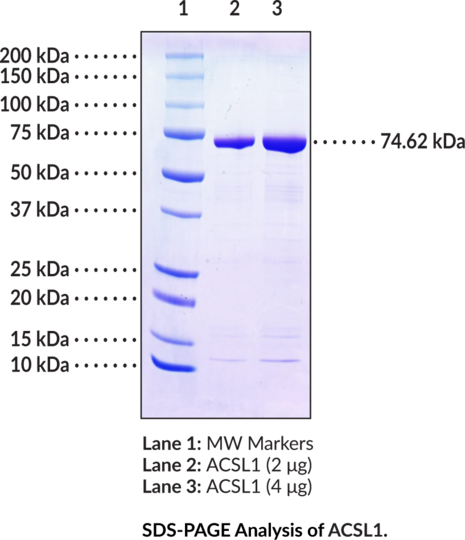 ACSL1 (human, recombinant, aa 48-698)
