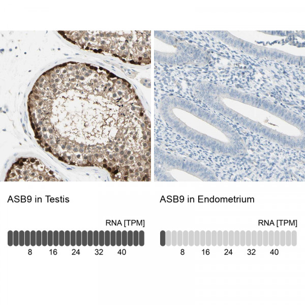 Anti-ASB9
