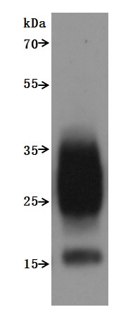 Transmembrane 4 L6 family member 1 (TM4SF1)-VLPs (Active), human, recombinant