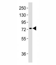 Anti-MeCP2