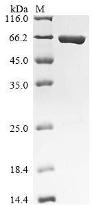 UPF0304 protein yfbU (yfbU), Biotinylated, Escherichia coli O6:H1, recombinant
