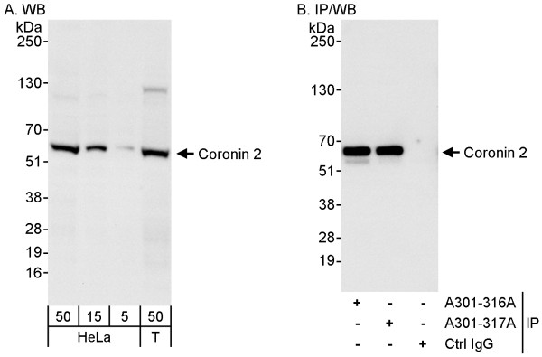 Anti-Coronin 2