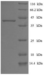 DNA polymerase catalytic subunit (BALF5), partial, Epstein-Barr virus, recombinant