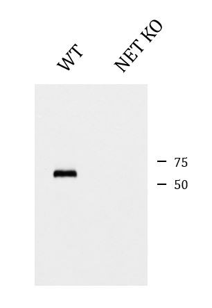 Anti-Norepinephrine Transporter, clone NET-05