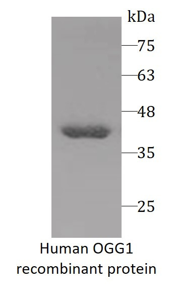 Human OGG1 recombinant protein (His-tagged)