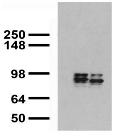 Anti-MMP9, clone S51-82
