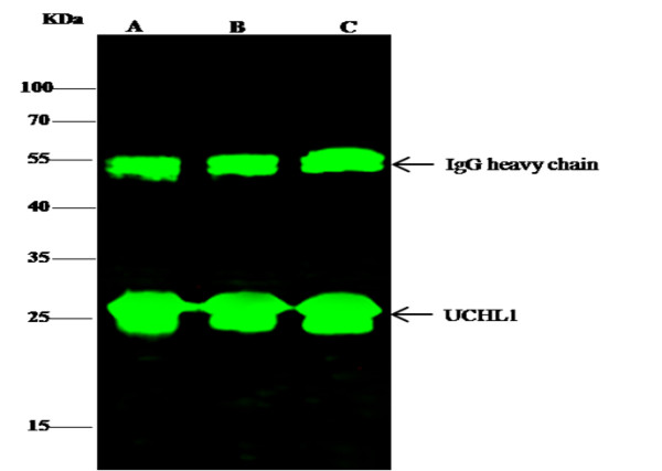 Anti-UCHL1/PGP9.5 Monoclonal Recombinant Antibody