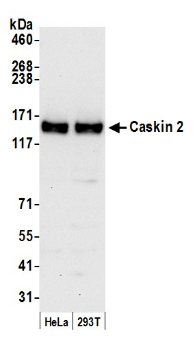 Anti-Caskin 2