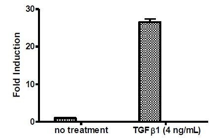 SBE Luciferase Reporter Lentivirus (TGFbeta/SMAD Pathway)