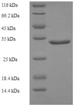 Growth arrest and DNA damage-inducible protein GADD45 gamma (GADD45G), human, recombinant