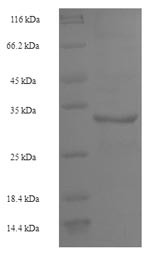 U6 snRNA-associated Sm-like protein LSm4 (LSM4), human, recombinant