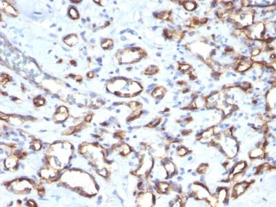 Anti-CD34 (Hematopoietic Stem Cell &amp; Endothelial Marker)(Clone: SPM610)