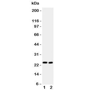 Anti-IL6