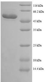 Trifunctional enzyme subunit beta, mitochondrial (HADHB),partial, human, recombinant
