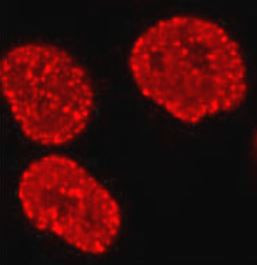 Anti-Histone H2A.X