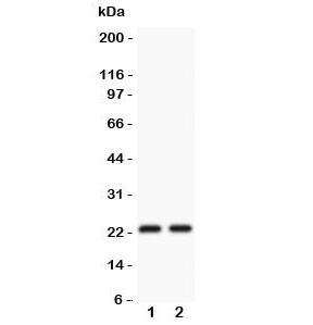 Anti-CD3 epsilon