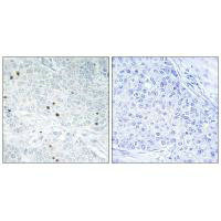 Anti-TP53INP2