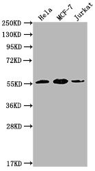 Anti-PKM Monoclonal, clone 4C8E12